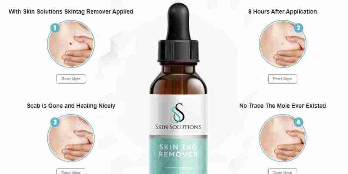 Skin Solutions Skin Tag Remover Remedy, Options, And More!